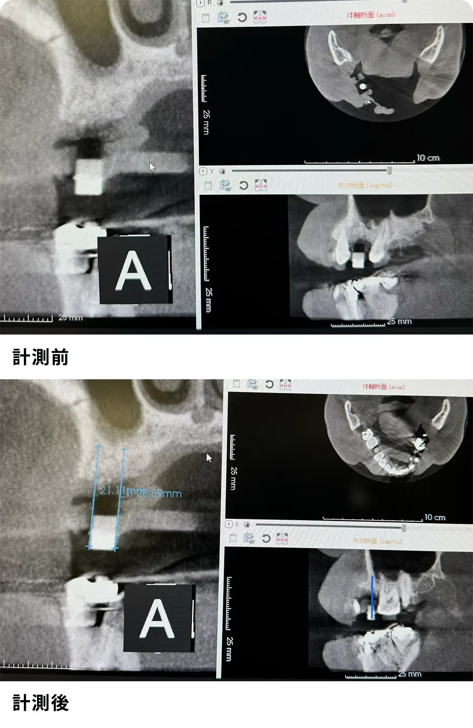 治療計画、設計レポート