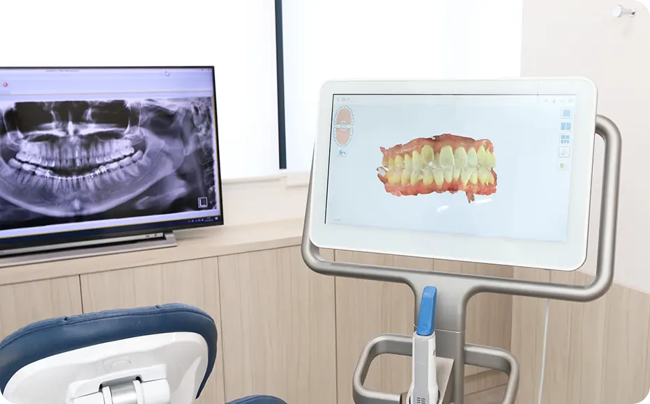 口腔内スキャナー（iTero）による歯型取りで不快感を軽減